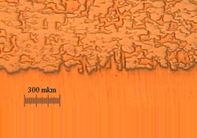 Sample structures of complex contacts